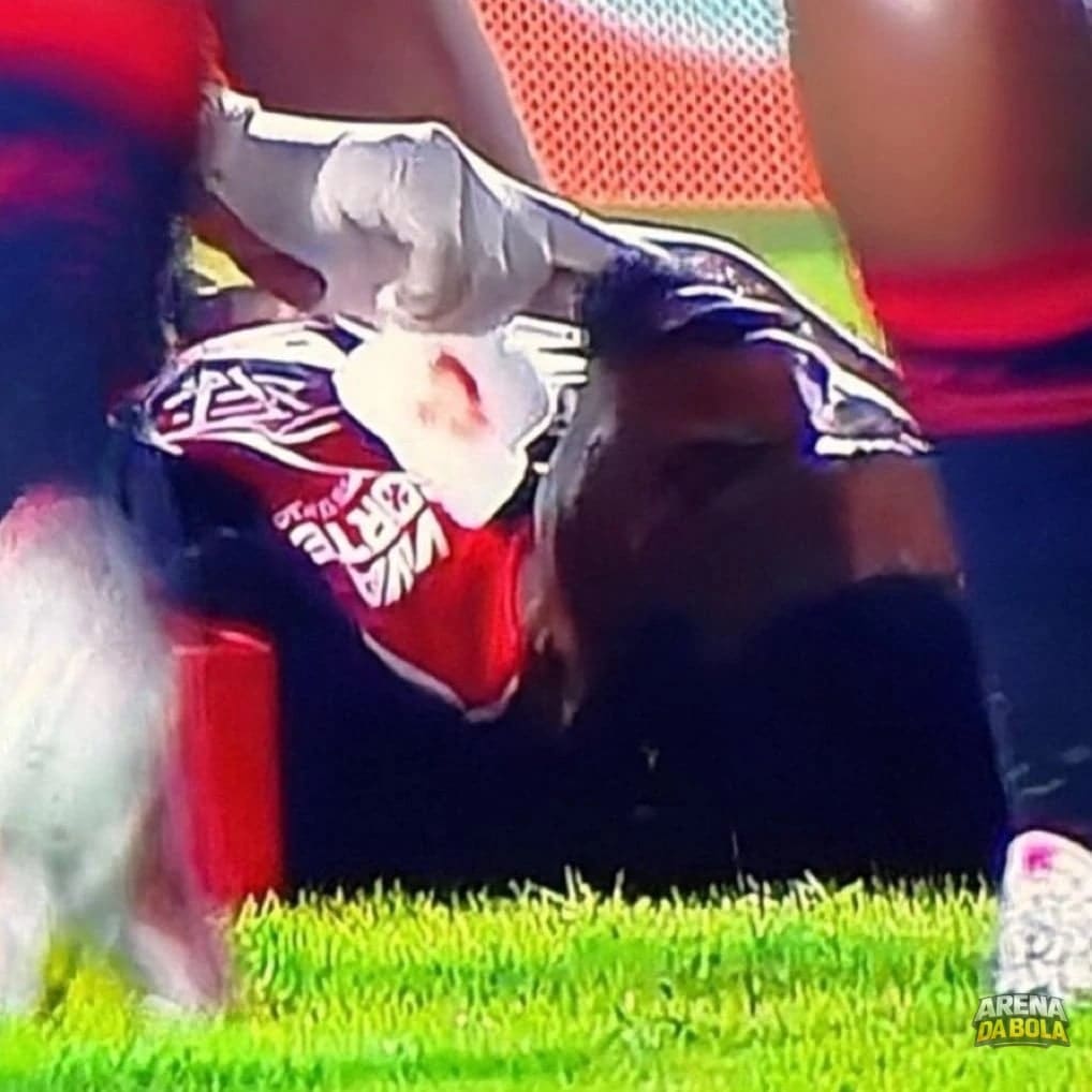 Polêmica no jogo: árbitro ignora VAR após lesão de jogador do Vitória